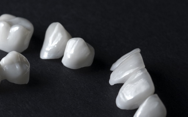 白い歯・セラミック治療 | 半蔵門の歯医者「パール歯科医院 半蔵門 